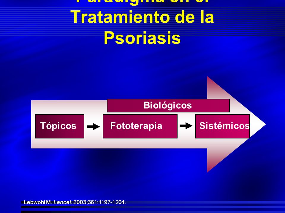 De que comienza la psoriasis el tratamiento